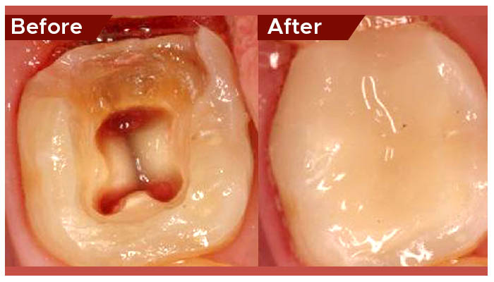 pediatric dentist in Abu Dhabi